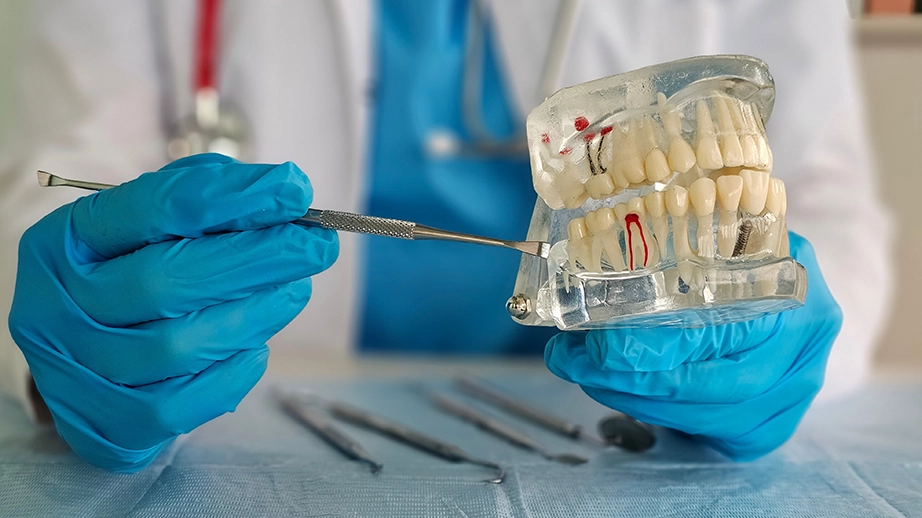 Dental professional demonstrating root canal procedure using a dental model
