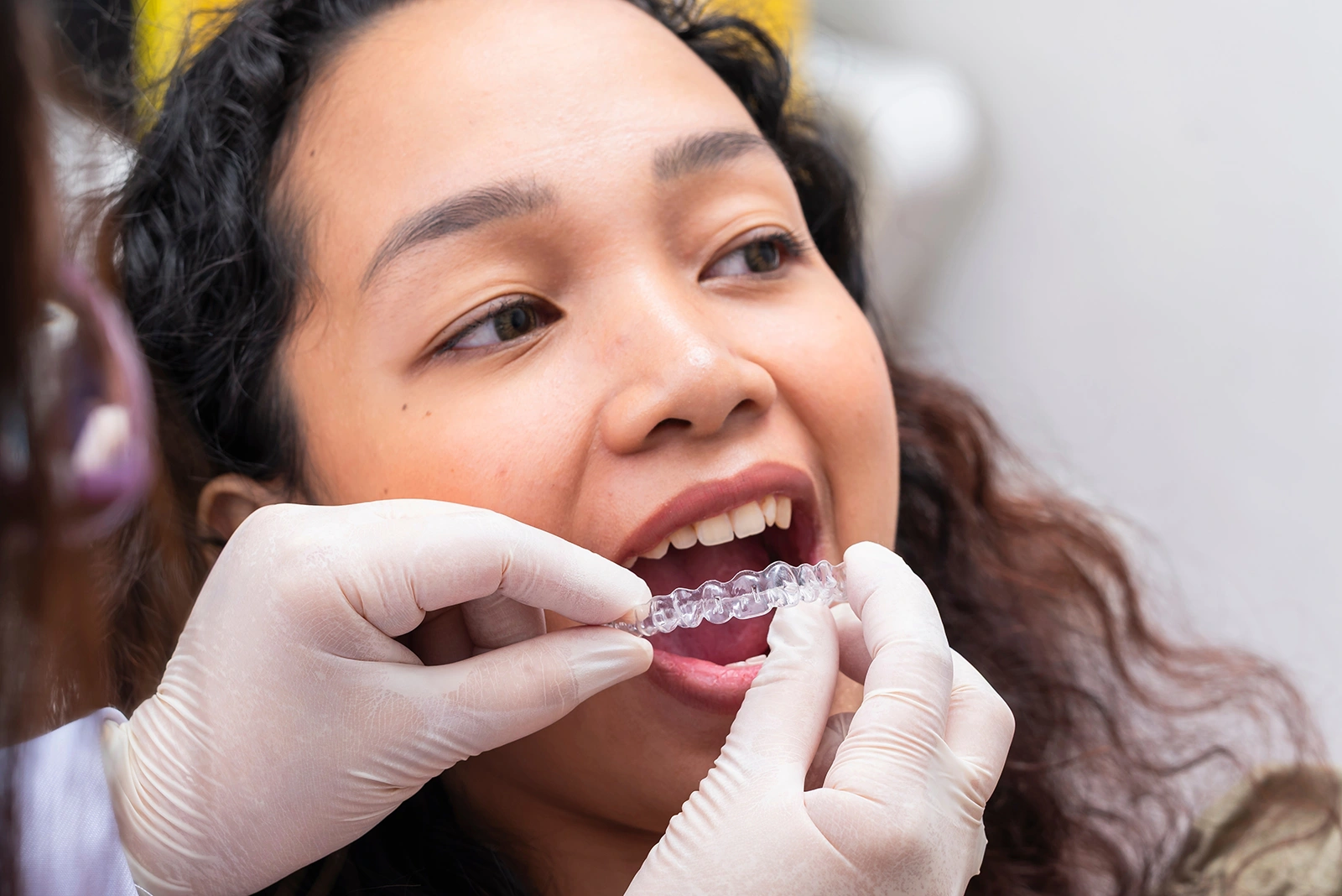 Consultation with an Invisalign dentist in Singapore
