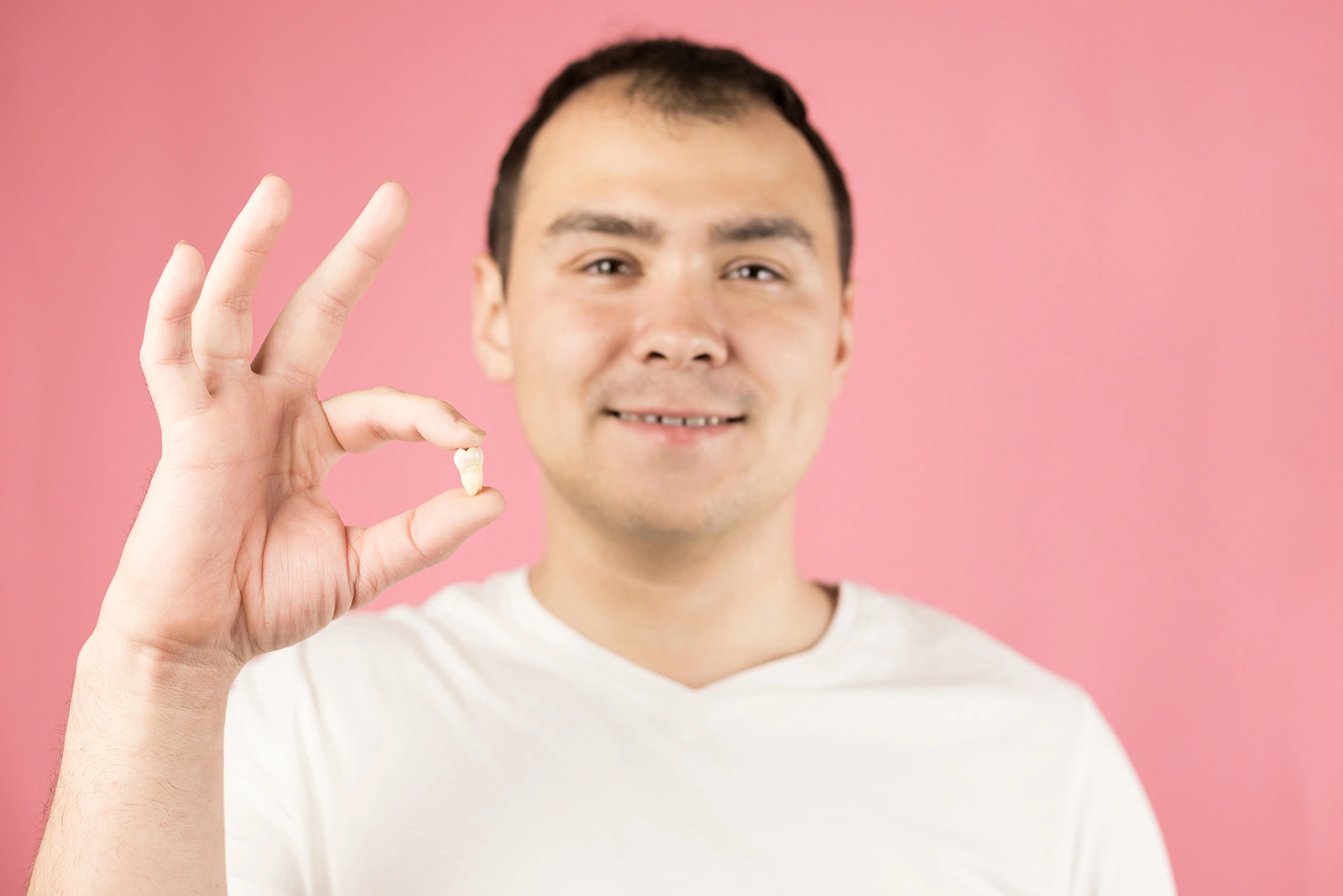 Man showing extracted wisdom tooth after removal surgery in Singapore