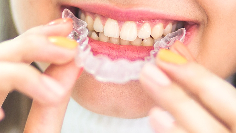 Woman holding a clear orthodontic retainer in front of her smile.