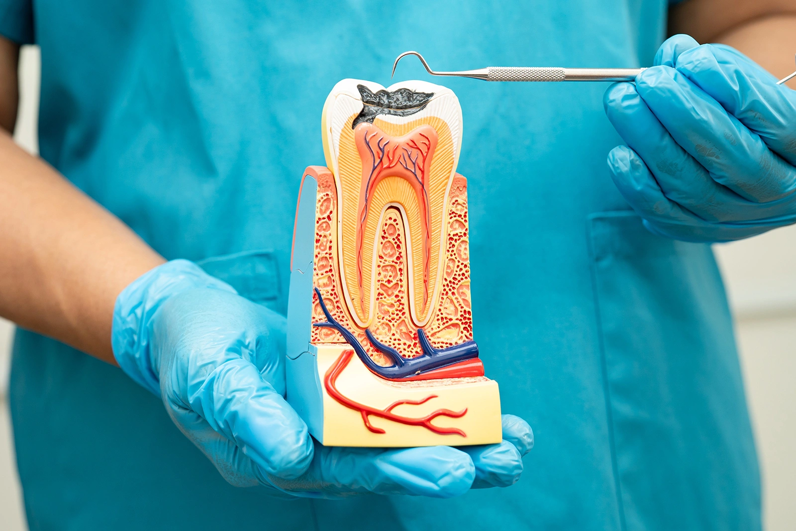 Dentist pointing at a tooth model during a root canal treatment consultation