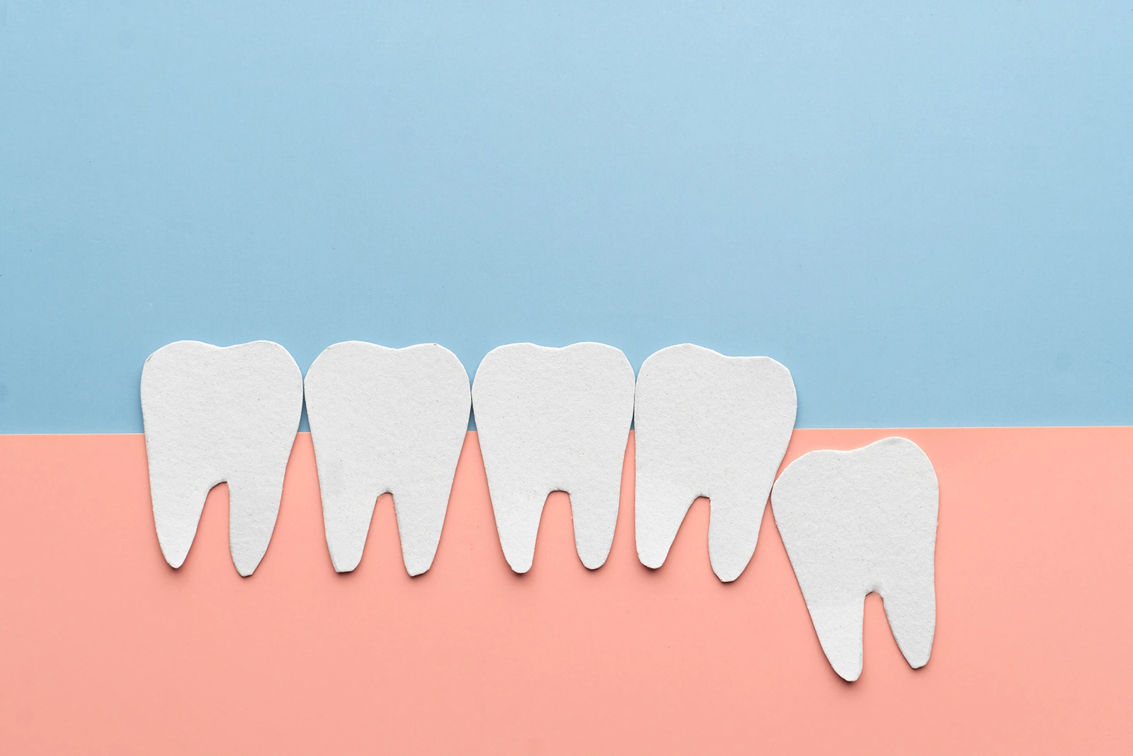 Impacted wisdom tooth that needs removal
